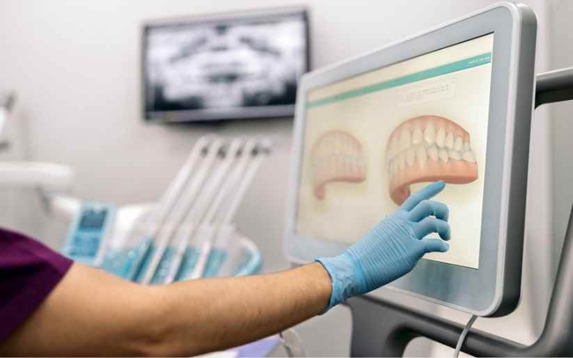 Invisalign Digital Smile Preview simulation